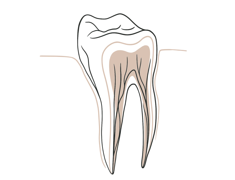 Cabinet EndoSpé, endodontie exclusive à Paris 15ᵉ